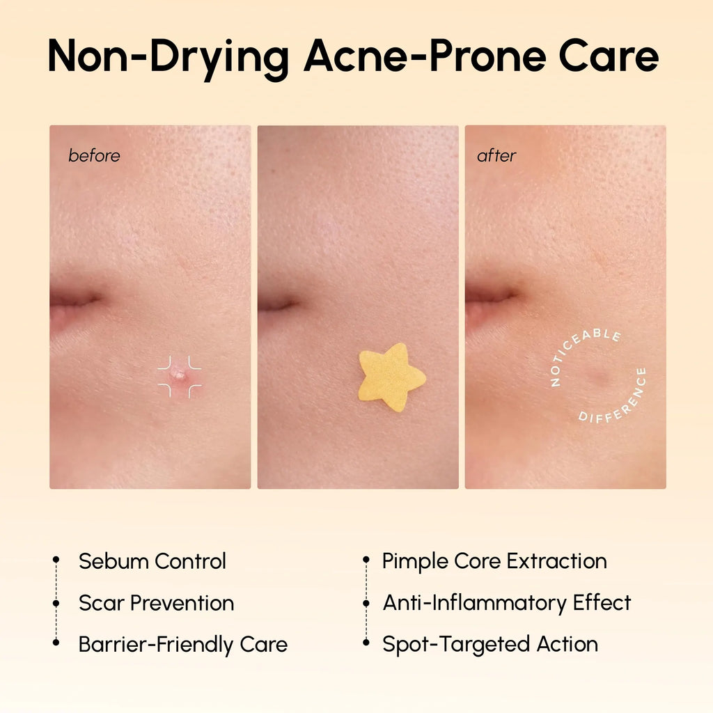 Gold Star Pimple & Acne Patches – BLOOM TASHA’S BOUTIQUE